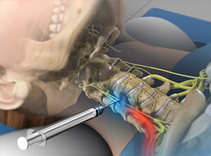 Cervical Spine